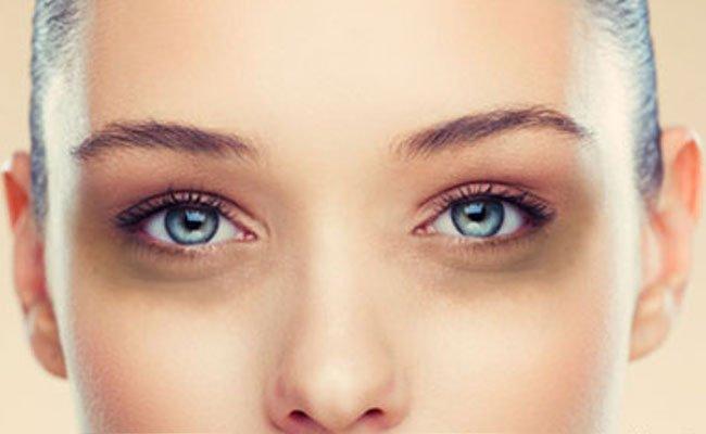 What causes sunken eyes? - Fawcett Mattress